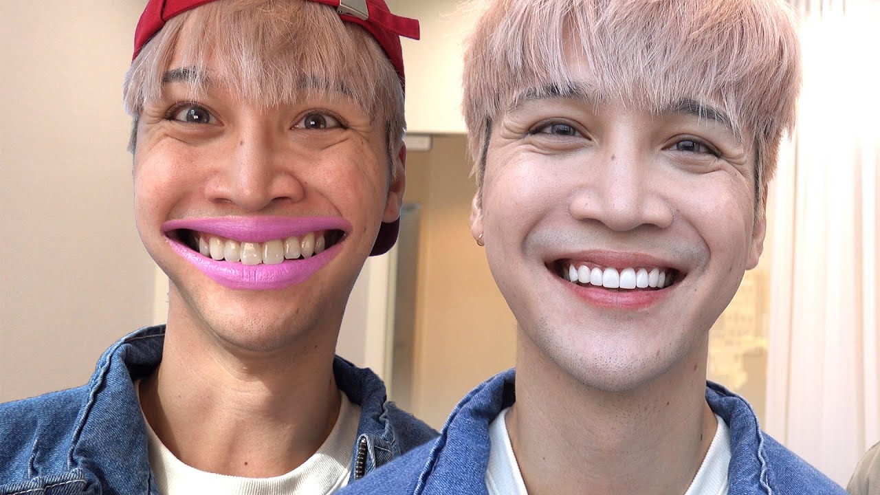 Getting myself a set of new laminated teeth (in just three hours heh) 라미네이트 - Edward Avila