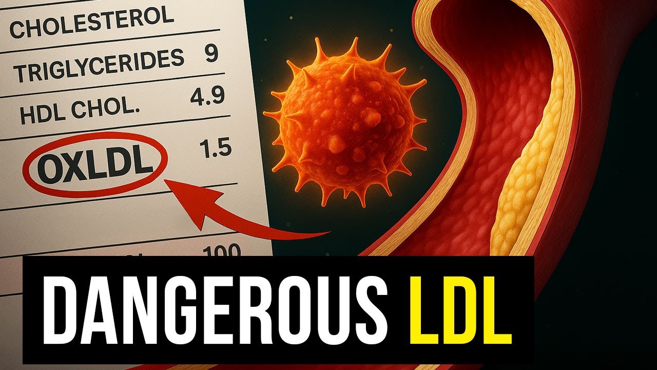Oxidized LDL: The Test That Could Save Your Heart (Cardiovascular Series) Ep. 04