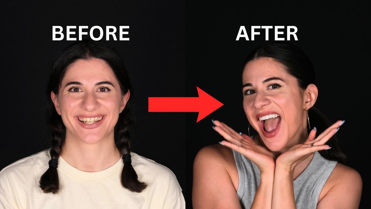 I Flew to Turkey for a Smile Makeover and It Changed My Life