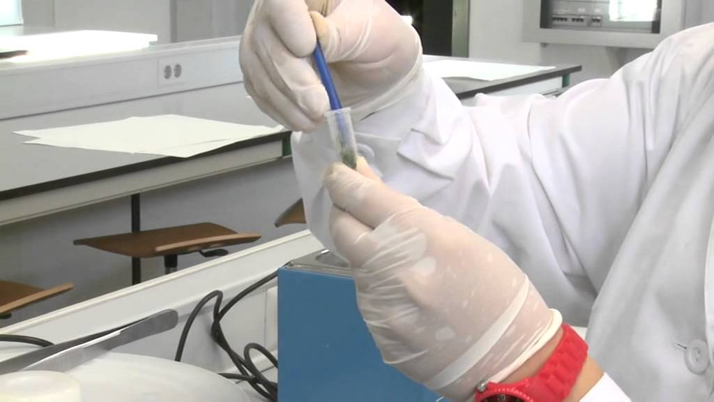 Extracción de DNA | 21/95 | UPV