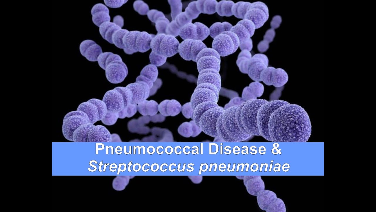 Pneumococcal Disease & Streptococcus pneumoniae
