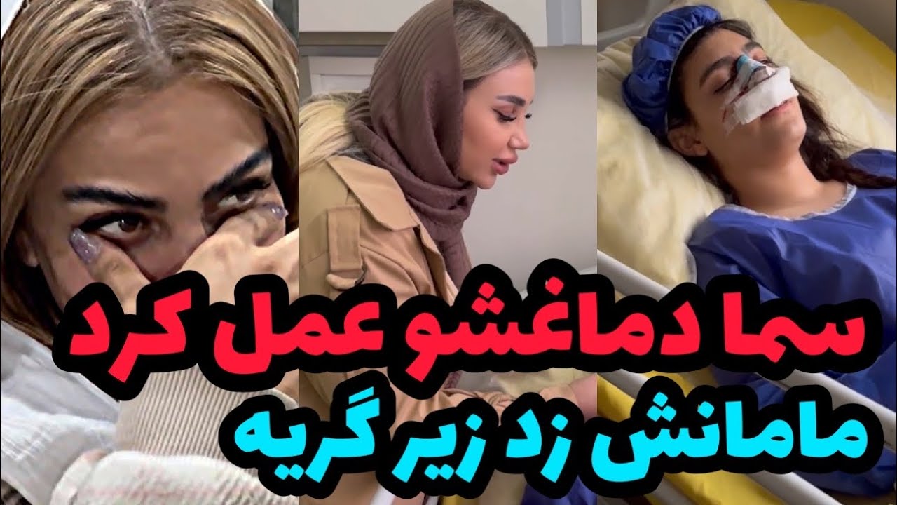 دماغ برادر زاده امیدو عمل کردیم❌😍