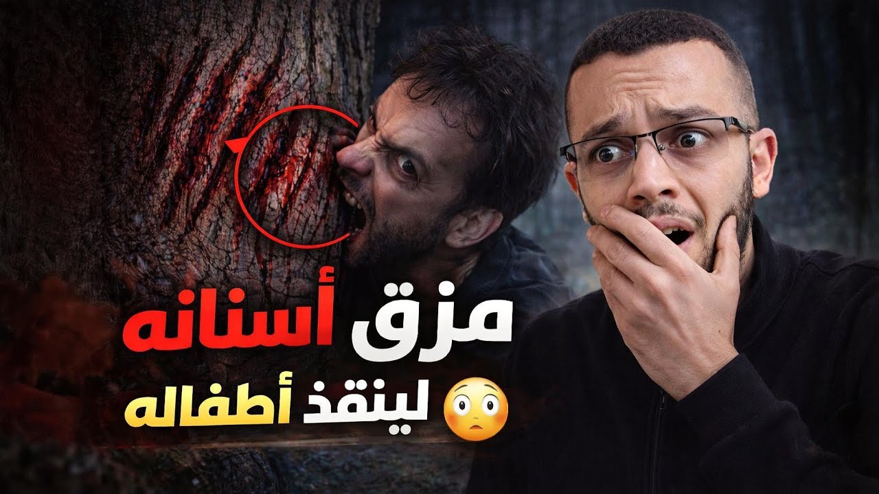 أب لسبعة أبناء أصيب بالسعار [ داء الكلب ] فضحى بأسنانه ...!
