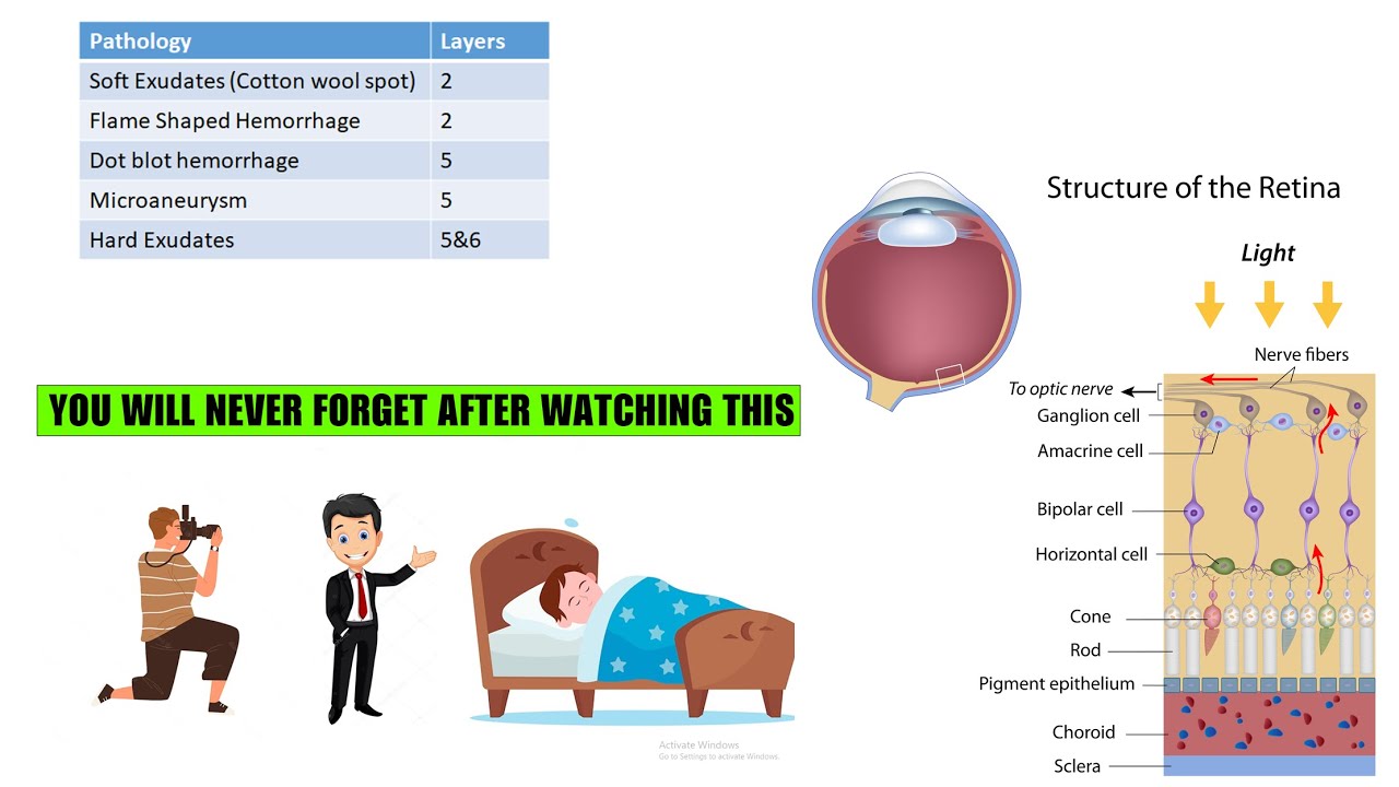 Genius trick remember layers of Retina and associated pathology | Ophthalmology | Physiology | Trick