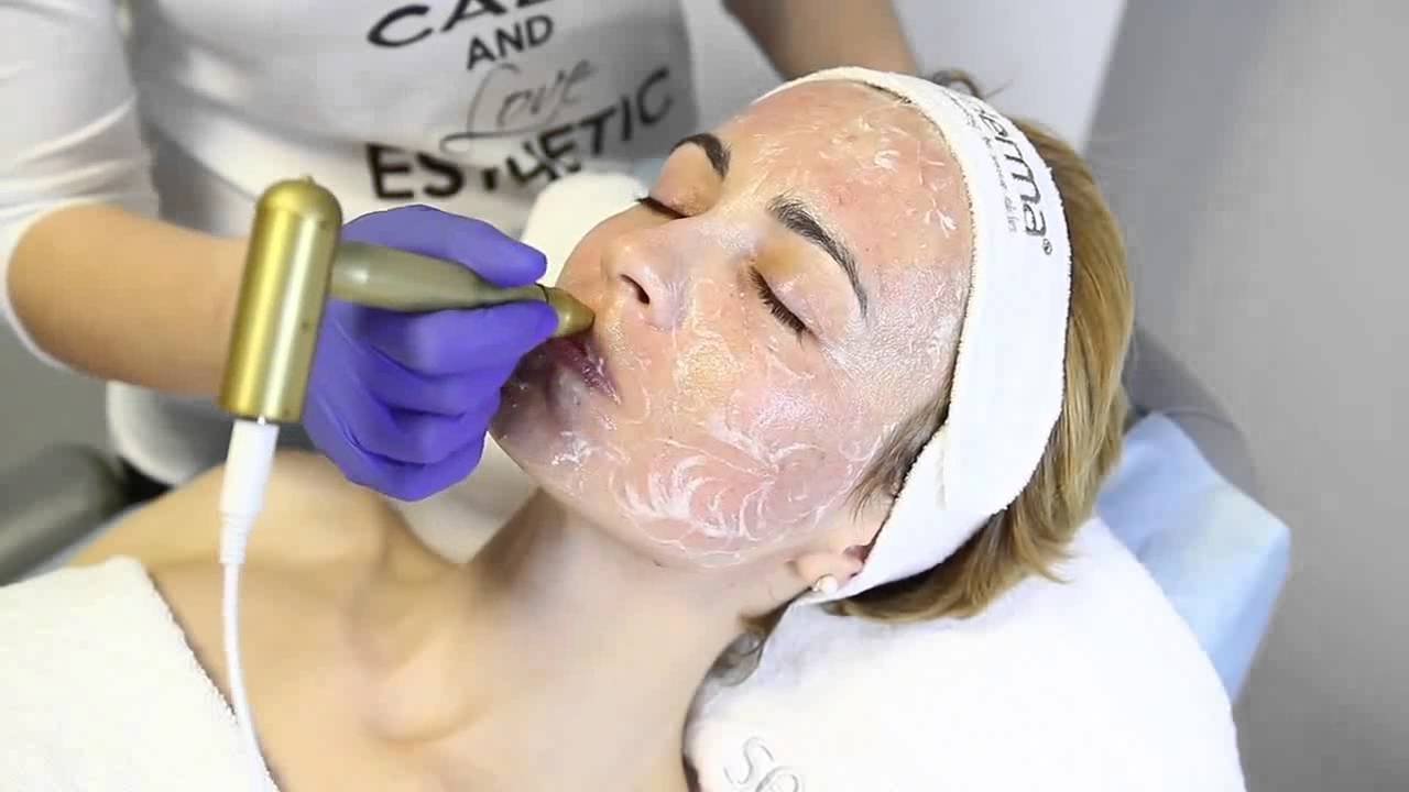 Sesderma  DNA Recovery Peel System i Nanopore Turbo Roller