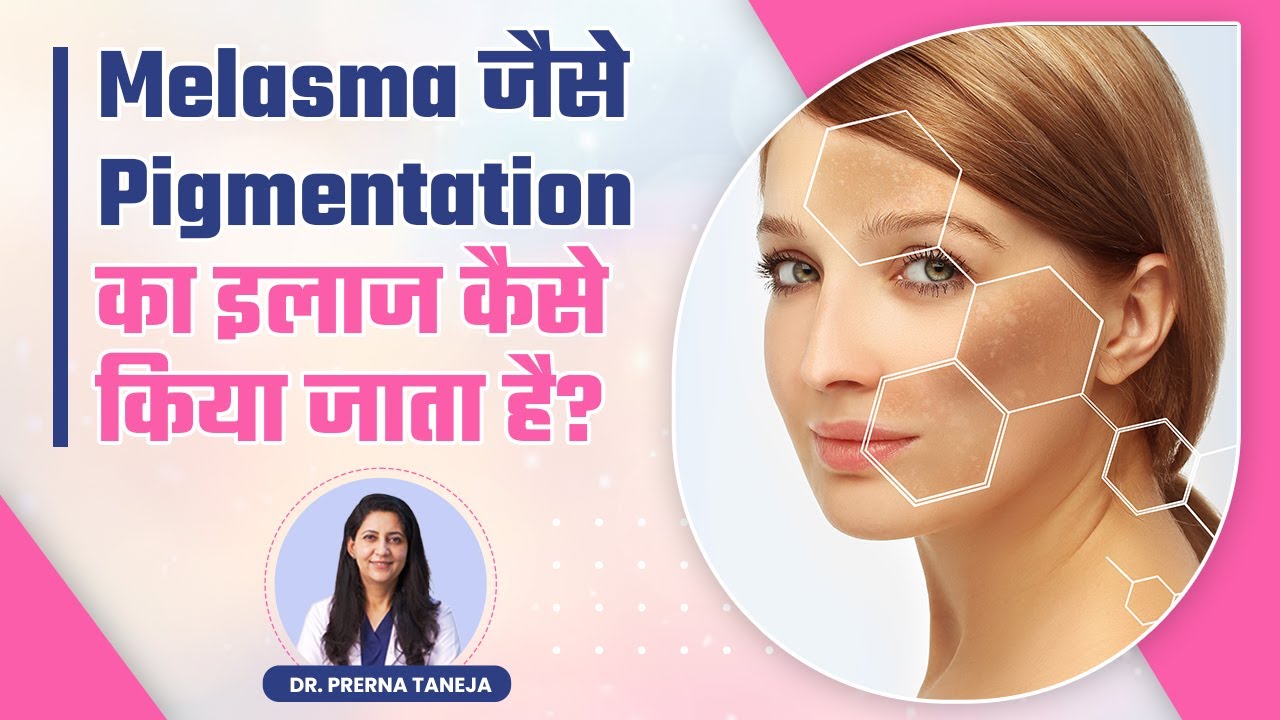 How to Treat Melasma / Pigmentation? What is the best treatment for Pigmentation? | Dr Prerna Taneja