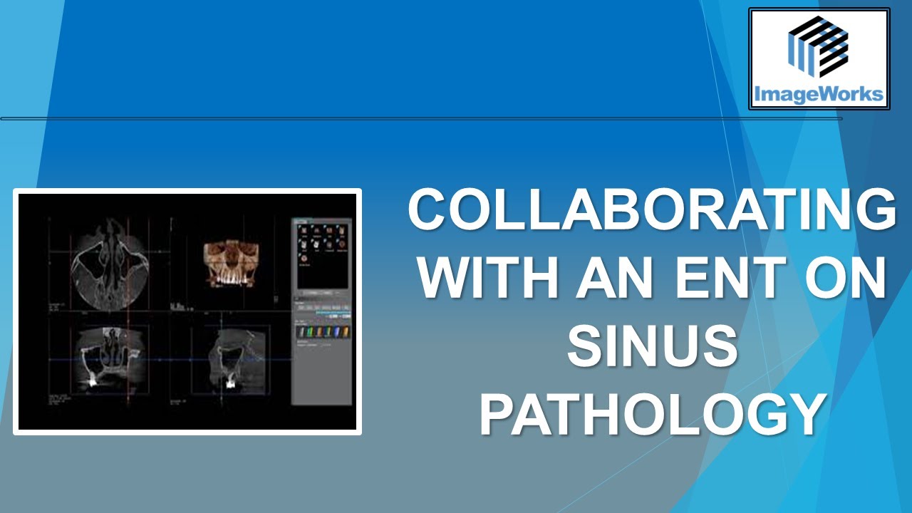 CBCT Case:  Patient with Sinus Trouble and how to work with ENTs