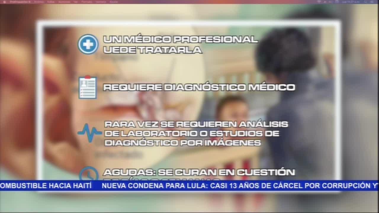 Salud: Otitis Media - Tu Pa&iacute;s al D&iacute;a por Super Canal 33