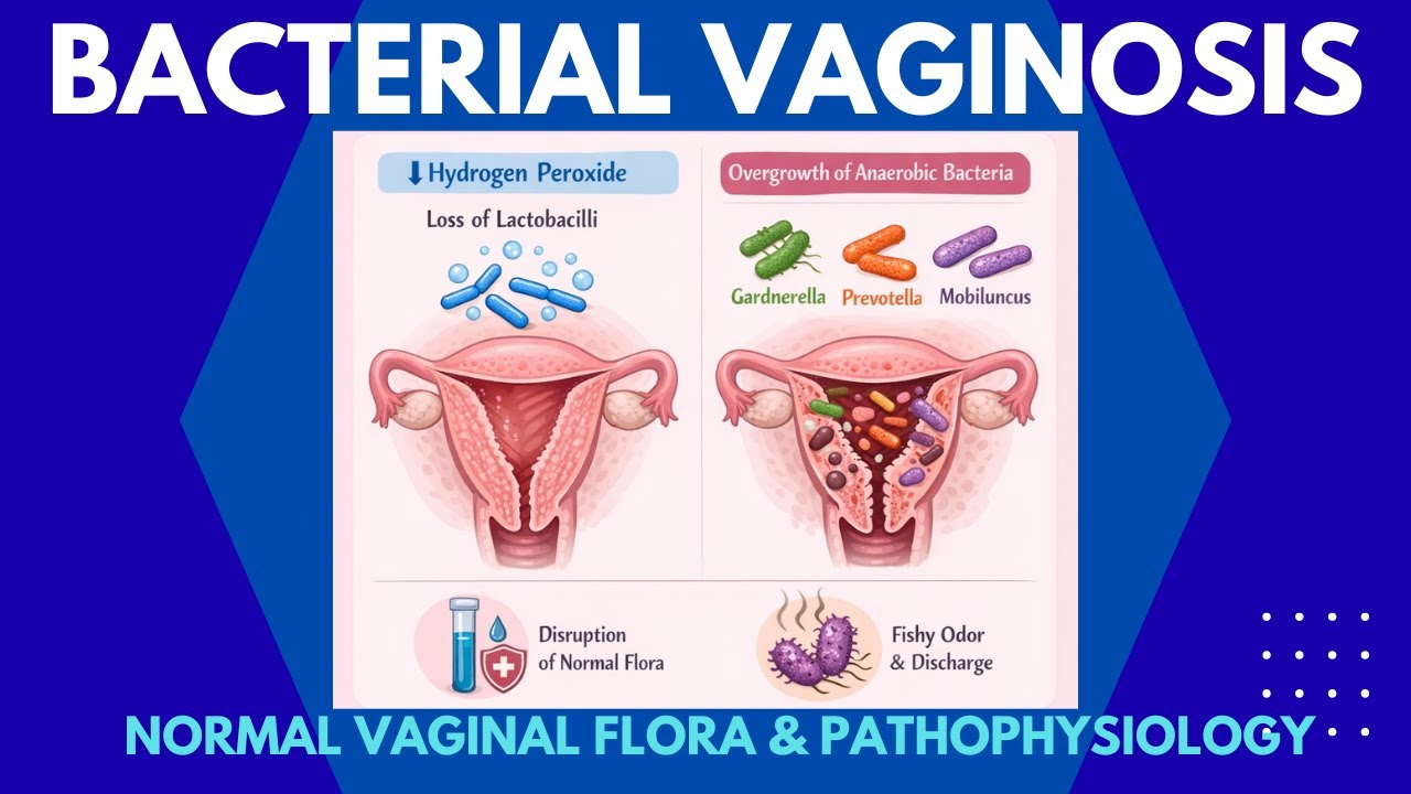 Bacterial Vaginosis (BV) – Normal Vaginal Flora & Pathophysiology | NEET PG | USMLE | Part 1