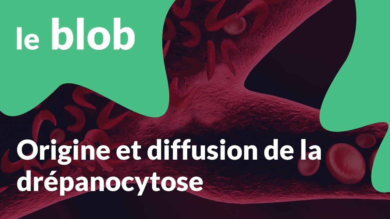 Origine et diffusion de la drépanocytose