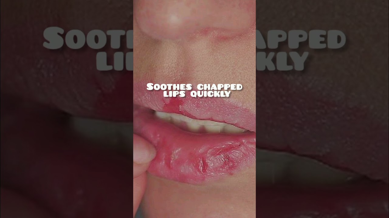 Vaseline Hacks #beautytipps #koreanskincare #skincare #beautyhacks #beauttips