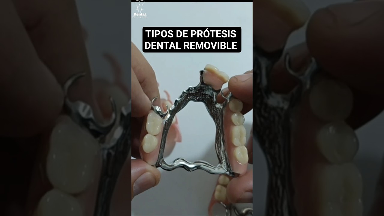 TIPOS DE PR&Oacute;TESIS DENTAL REMOVIBLES #hagamosequipodental #dentista #pr&oacute;tesisdental