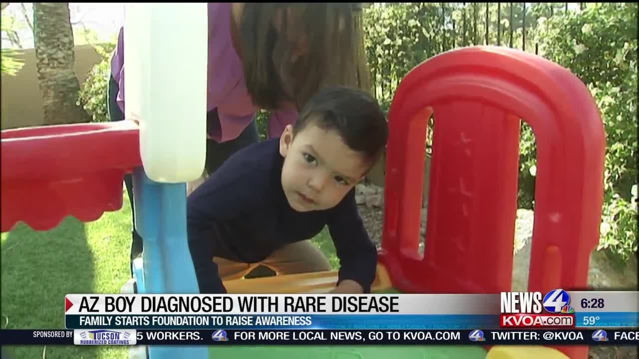 Boy diagnosed with rare disease