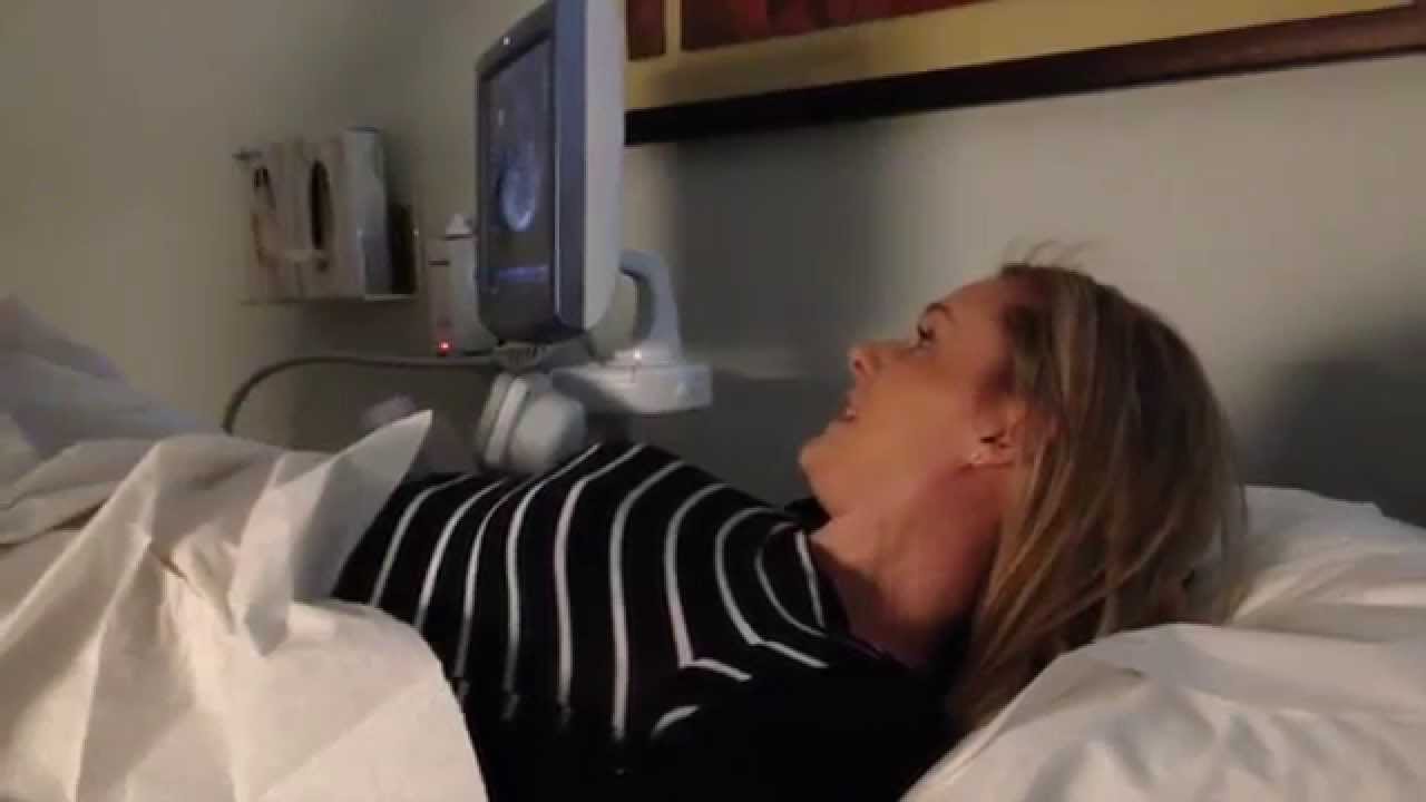 Surprise! You're Pregnant with Twins