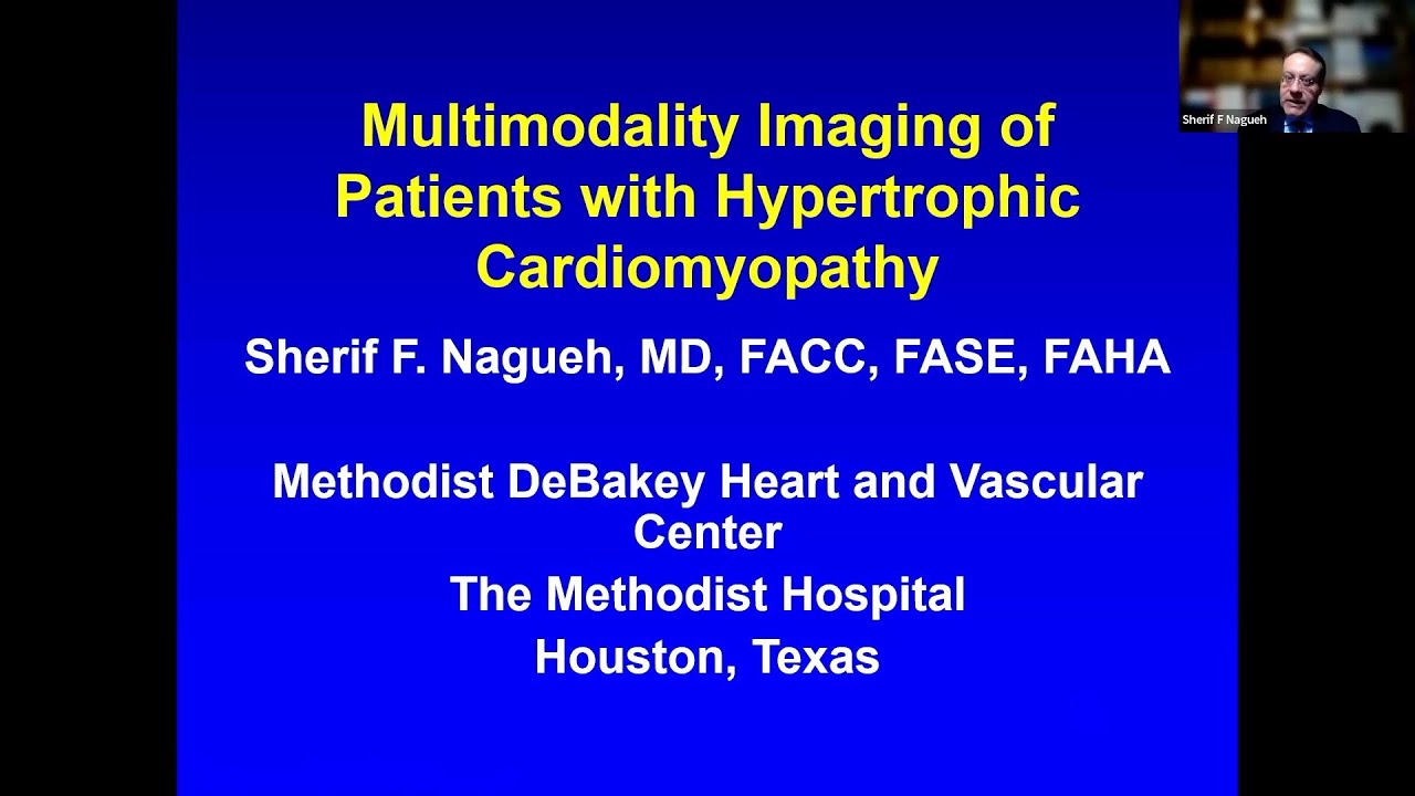 Multimodality Imaging of HCM Patients