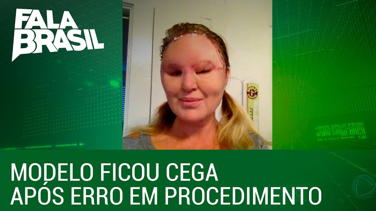 Saiba os cuidados a serem tomados antes de procedimentos est&eacute;ticos