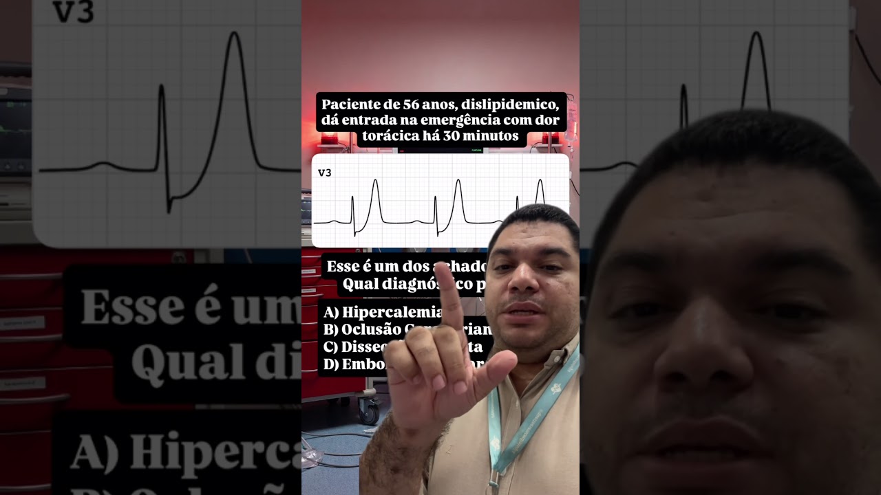 Aprenda ECG em 1 dia. Retiro ECG. #cardiologia