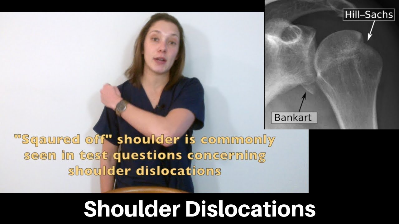 Shoulder dislocation: presentation, physical exam, and imaging