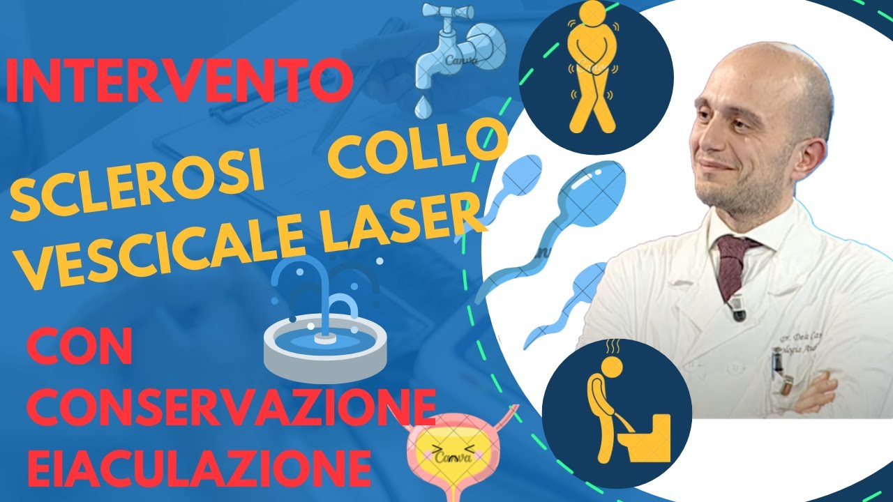 INCISIONE LASER COLLO VESCICALE CON CONSERVAZIONE DELL EIACULAZIONE PER SCLEROSI DEL COLLO VESCICALE