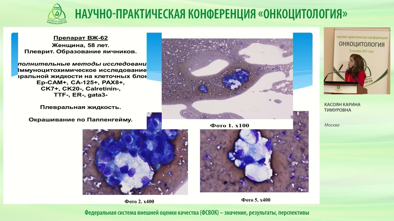 Федеральная система внешней оценки качества (ФСВОК) – значение, результаты, перспективы