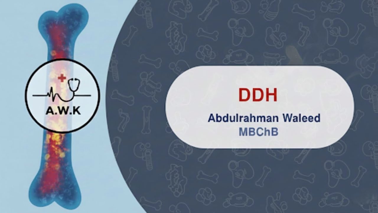 Orthopedic diseases “ DDH” 