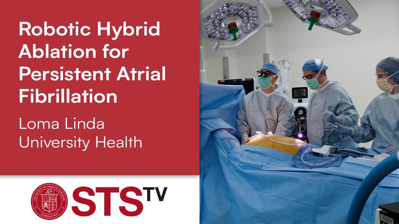 Robotic Hybrid Ablation for Persistent AFib &ndash; Loma Linda Department of Cardiothoracic Surgery
