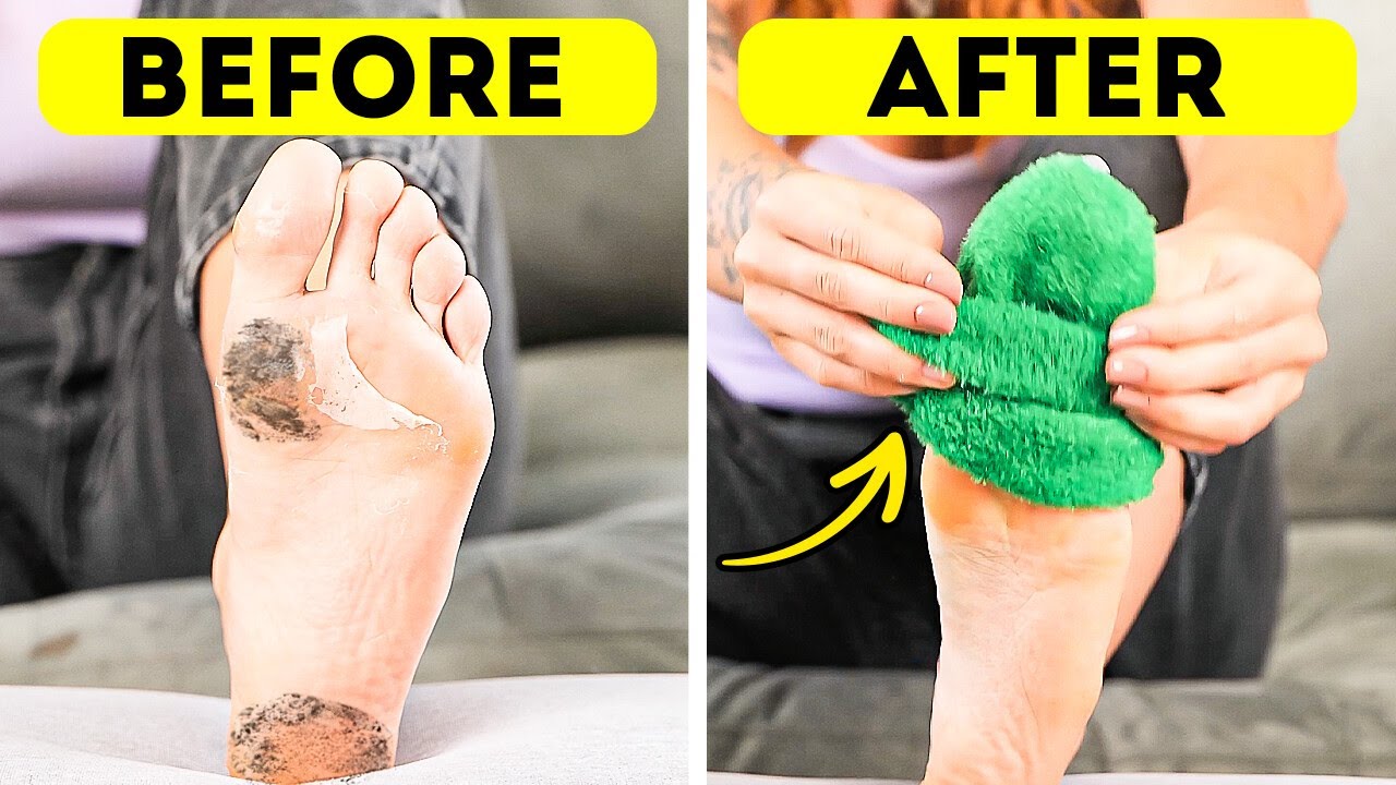 Piedi Pronti per l'Estate? Prova Questi Semplici Hack per Un Look Glowy! 💅👡
