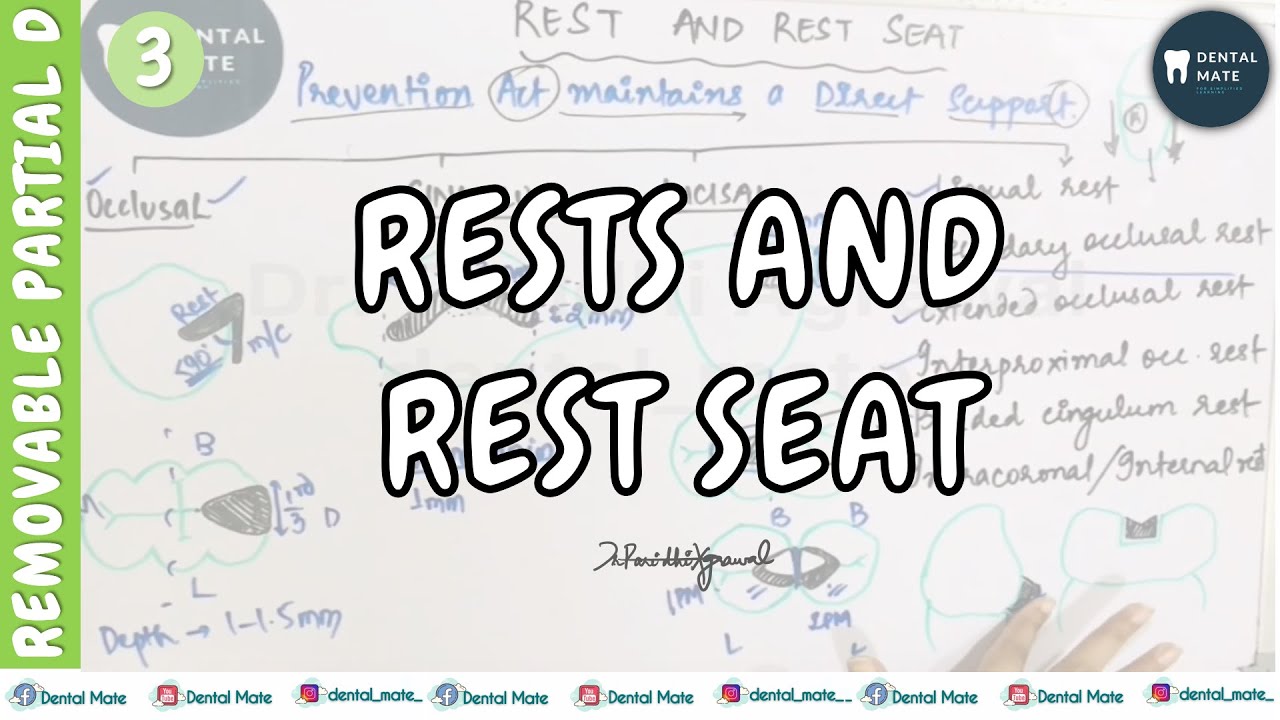 Rest and Rest seat | Types of rest | Occlusal, Cingulum, Incisal, Lingual | Pneumonics | Dr Paridhi
