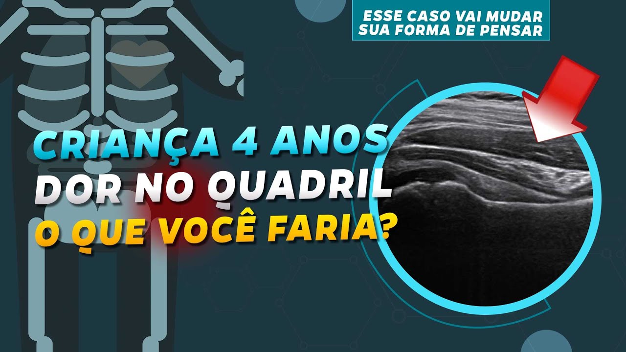 Ultrassom de quadril - o que temos aqui? MSKD Casos 39