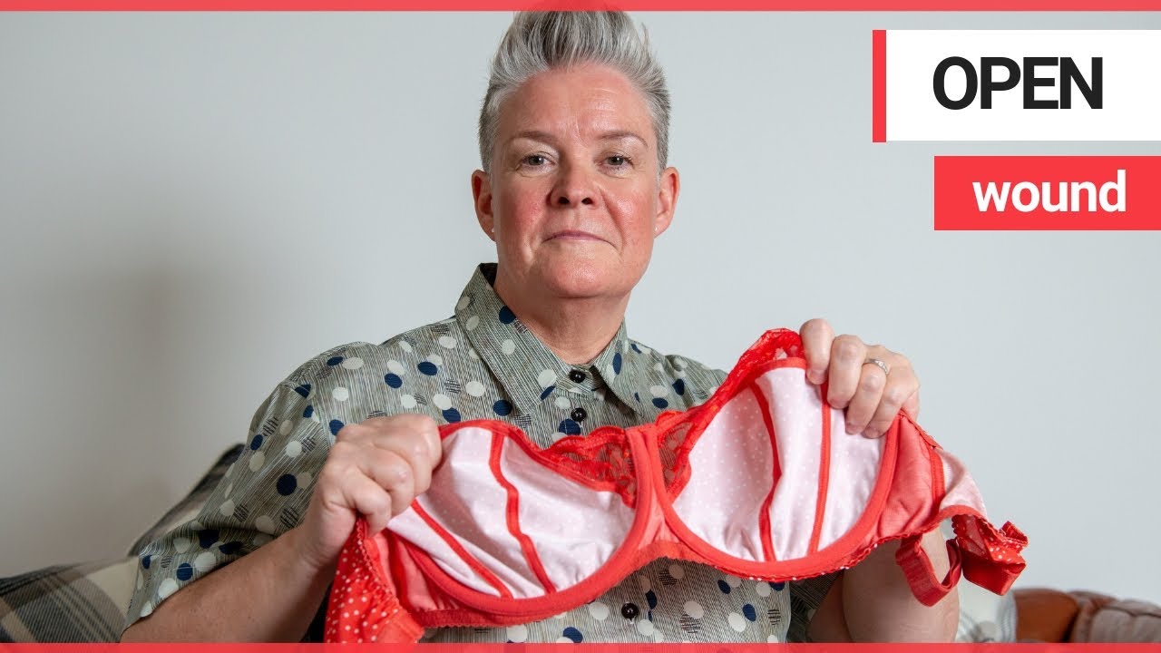 A woman claims she was left with a gaping hole in her chest thanks to underwire bra