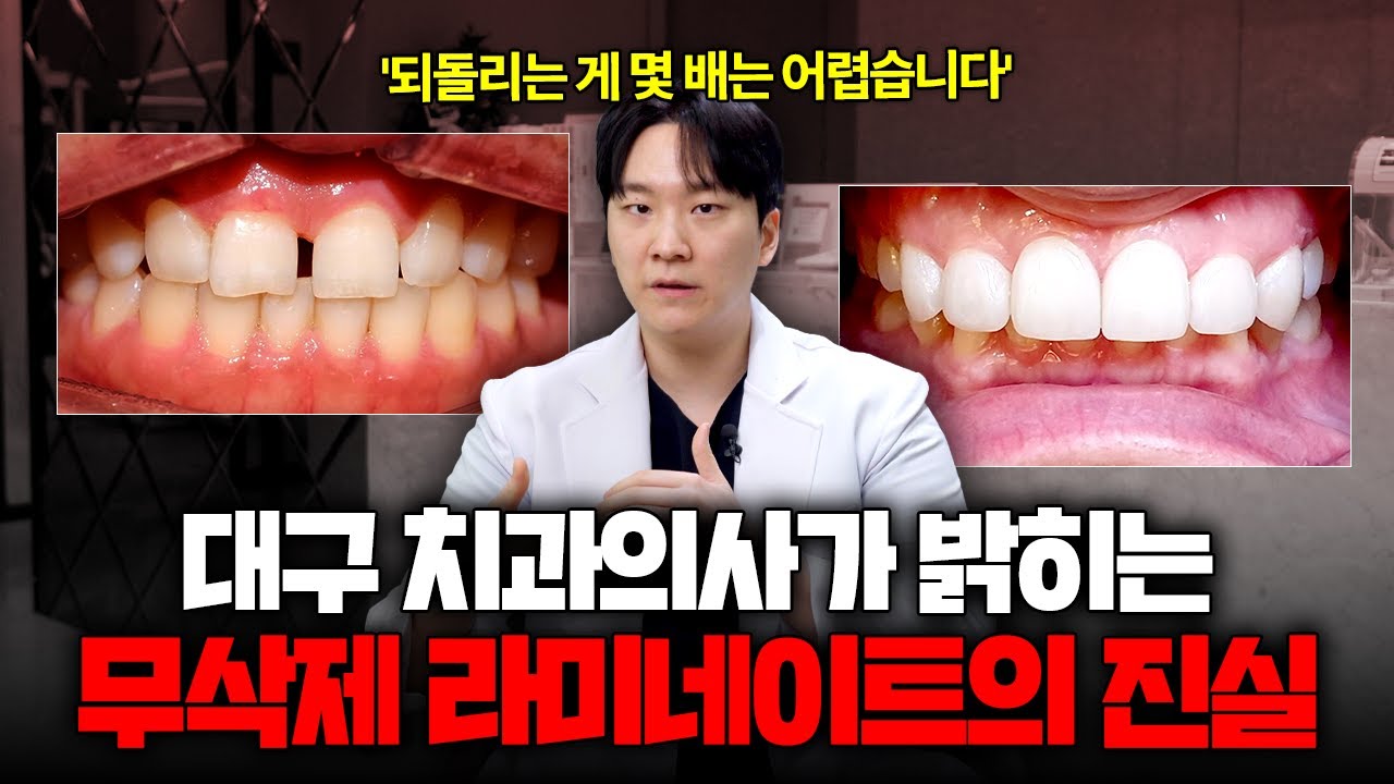 무삭제 라미네이트 Q&A 총정리 해드립니다 [대구치과, 대구라미네이트]