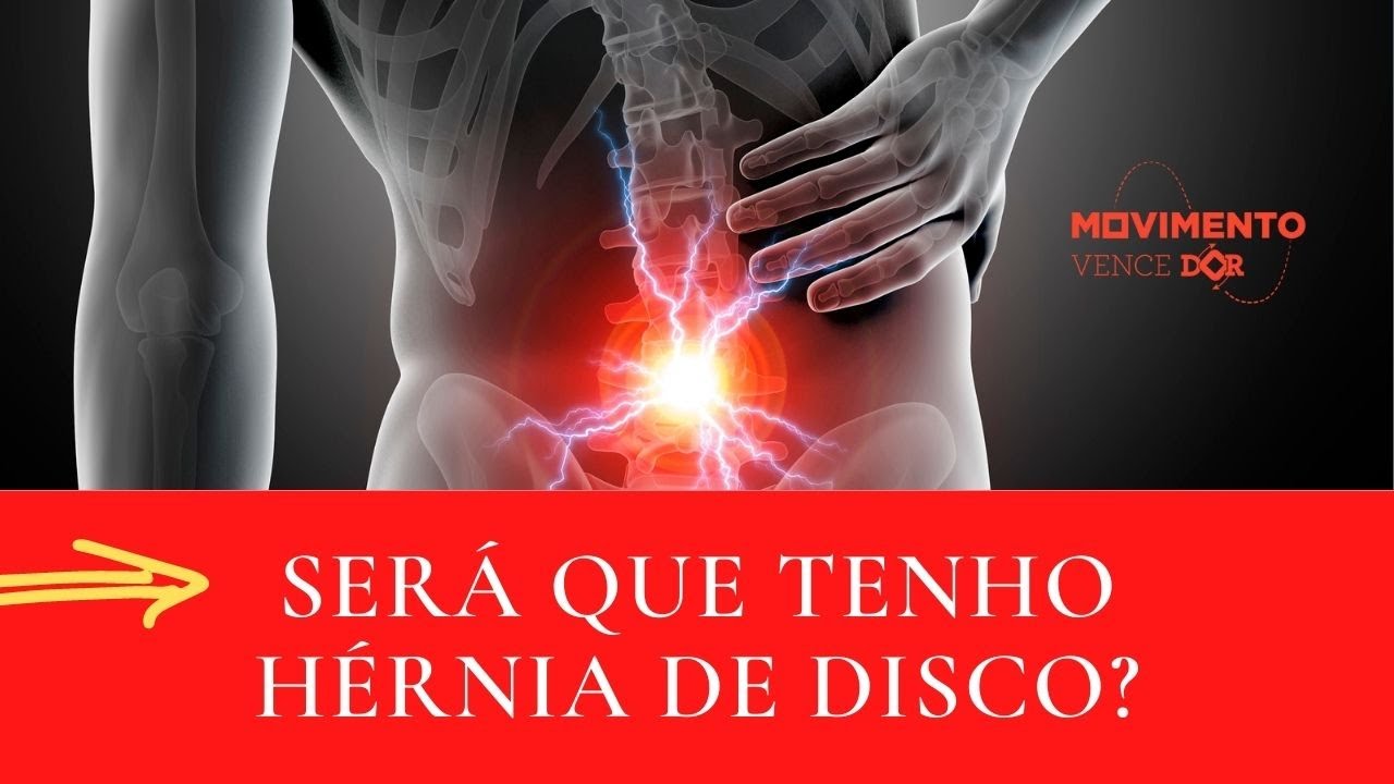 5 Sinais que você pode ter Hérnia de Disco