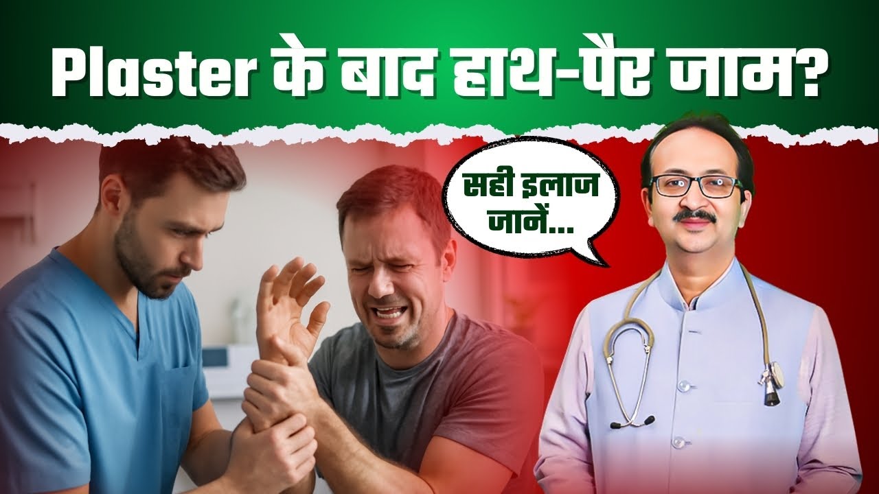 Plaster के बाद हाथ या पैर जाम हो जाए तो क्या करें? | Orthopedic Tips #drrameshwarkumar
