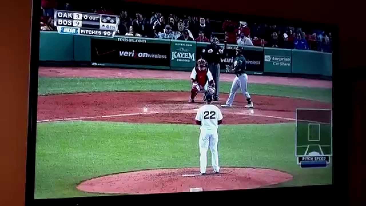 Jerry Remy  tries different hairstyles and the bald look