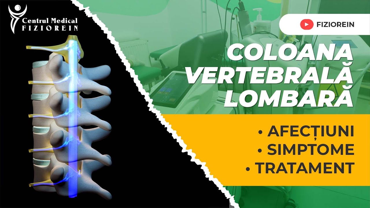 Coloana vertebrală lombară-Centrul Medical Fiziorein