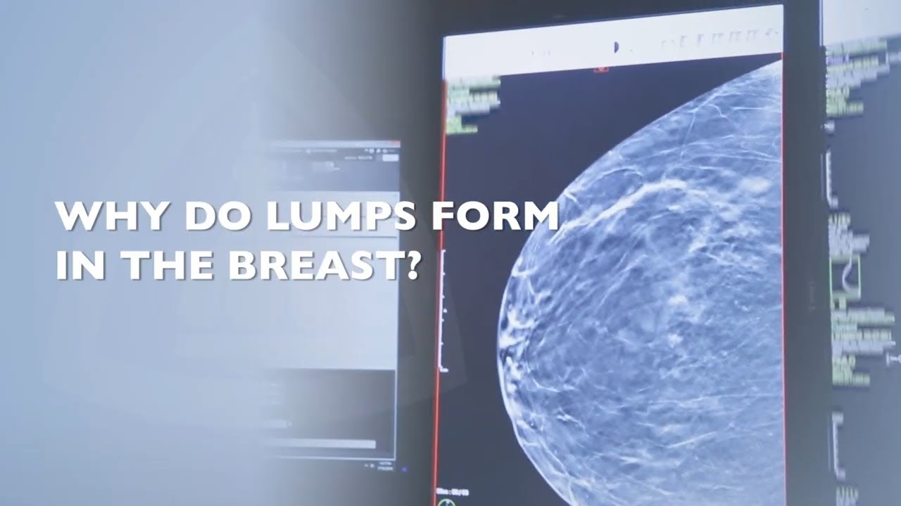 What To Do When You Find a Lump in Your Breast?