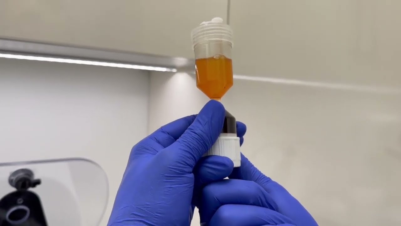 World PRP preparation