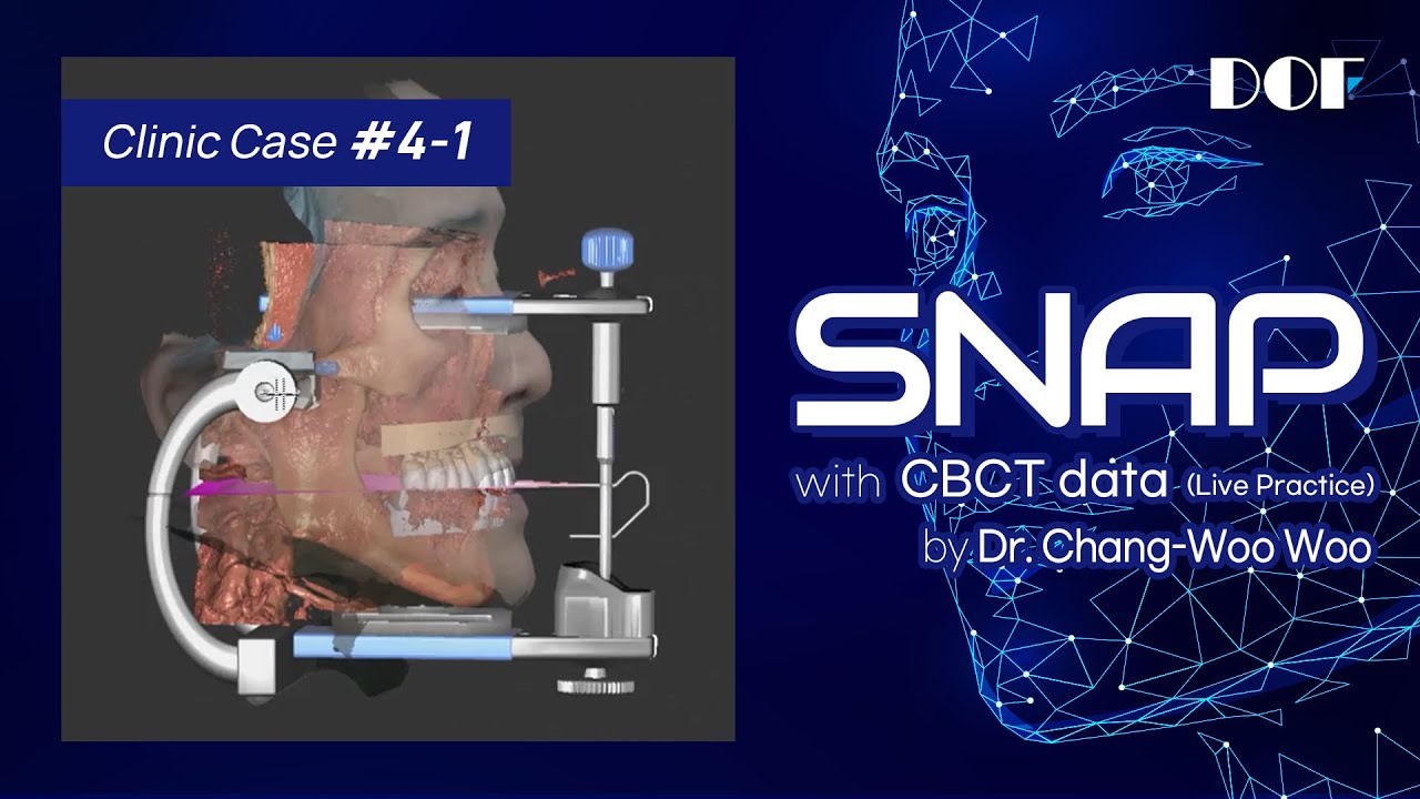 exocad Insights DOF's Session #4.1 with Face Scanner SNAP