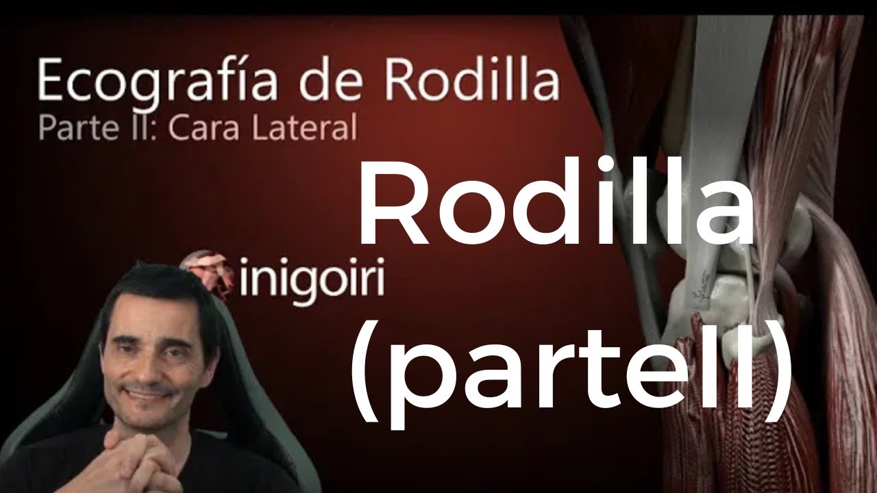 ECOGRAFÍA DE LA RODILLA (PARTE II) | Cara Lateral: Anatomía, Técnica y Trucos