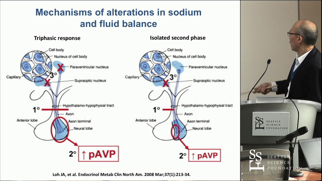 Postoperative Management of Pituitary Tumors - Kevin C.J. Yuen, MD, FRCP(UK), FACE