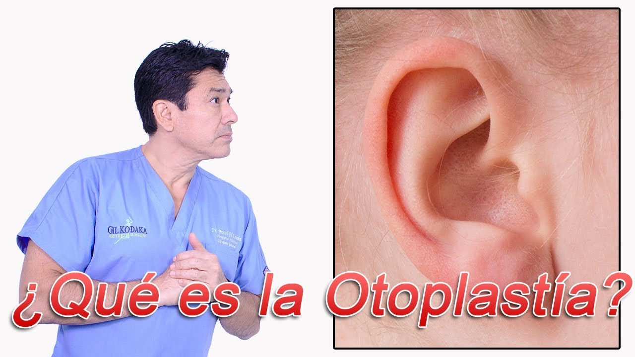 La Otoplastía - Cirugia de las Orejas
