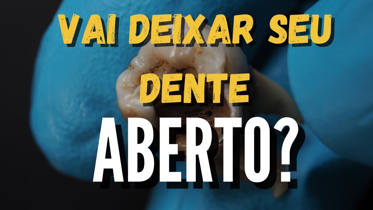 Curativo do canal caiu e dente est&aacute; aberto