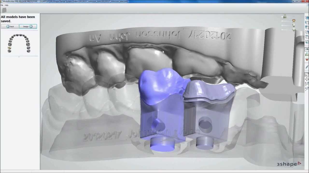 Dental System&trade; 2012 - Model Builder&trade;