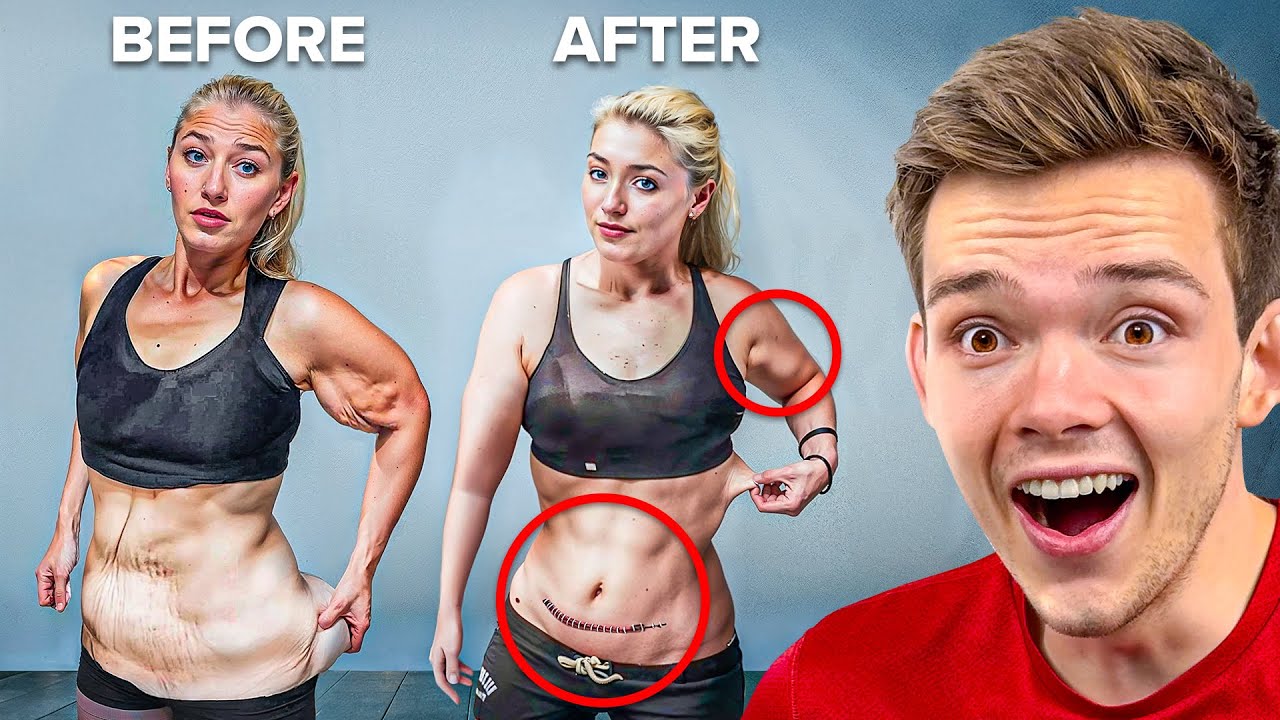 Incredible Weight Loss & Excess Skin Removal Transformations