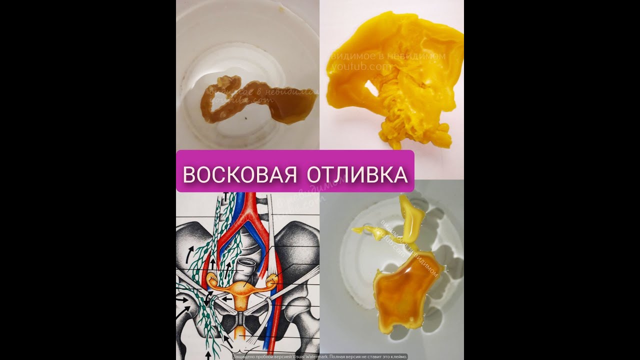 восковые отливки