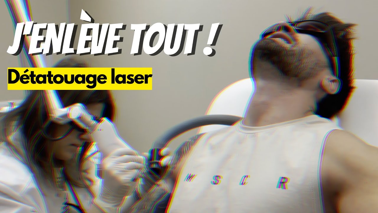 JE ME FAIS ENLEVER TOUS MES TATOUAGES AU LASER ! EP.01