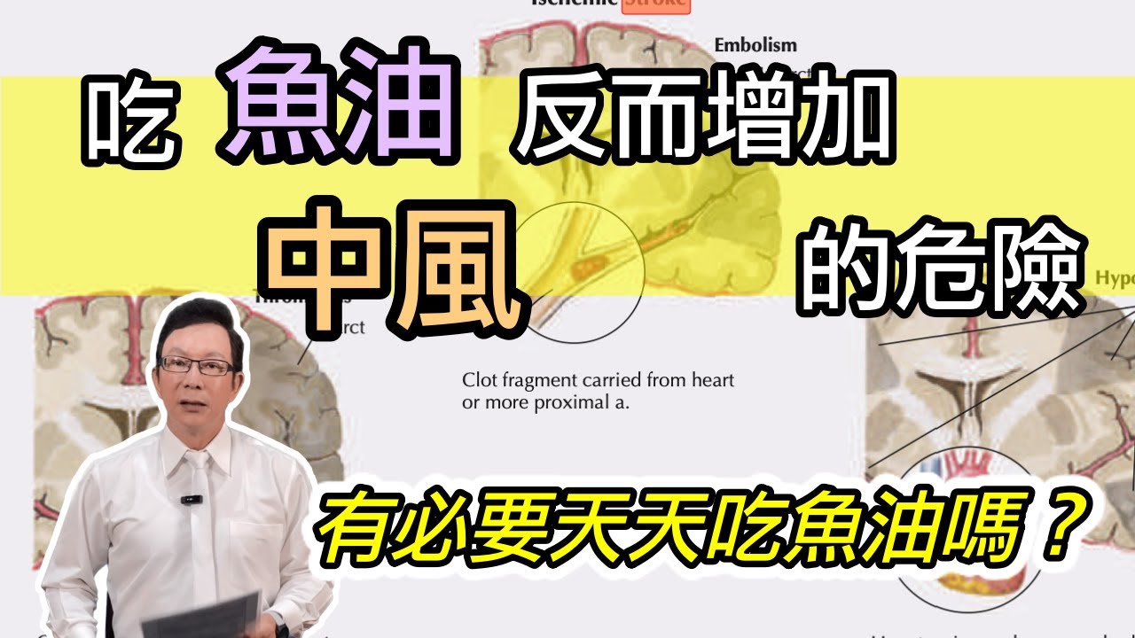 吃魚油沒有你想的健康！健康的人需要每天吃魚油嗎？邱醫師不吃魚油的2個原因 Taking fish oil is not as healthy as you think.
