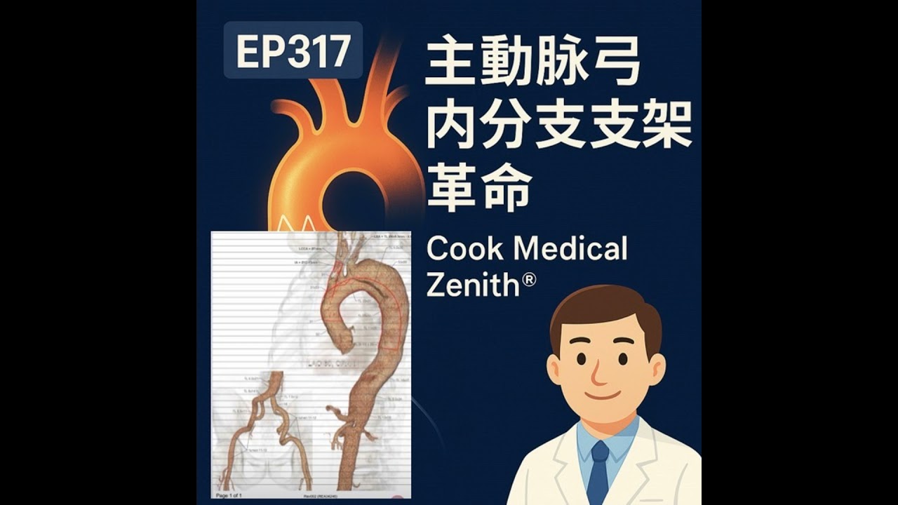 🎙️EP317｜COOK Zenith® 客製化主動脈弓支架系統