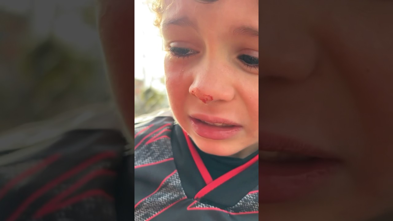 Yusuf Emre’nin yüzüne gelen top sonrası, akan gözyaşları 