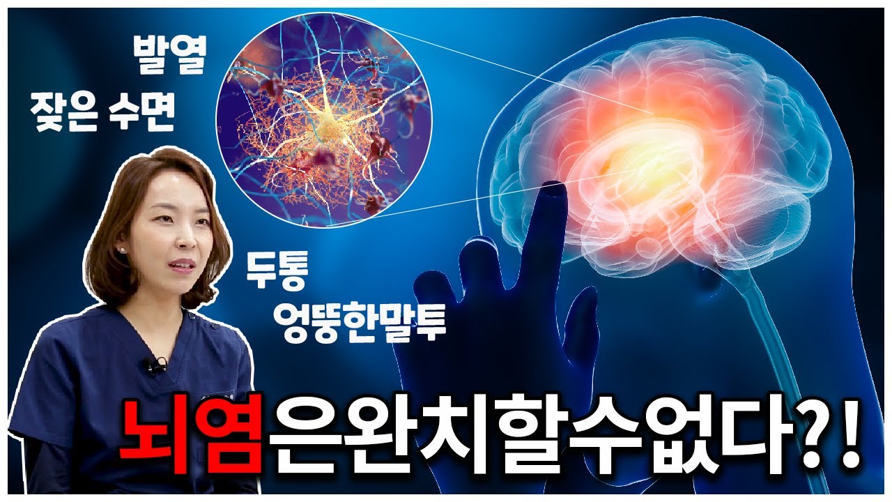 뇌염은 완치가 불가능하다?! 자가면역성 뇌염과 일반뇌염 원인과 증상, 치료법